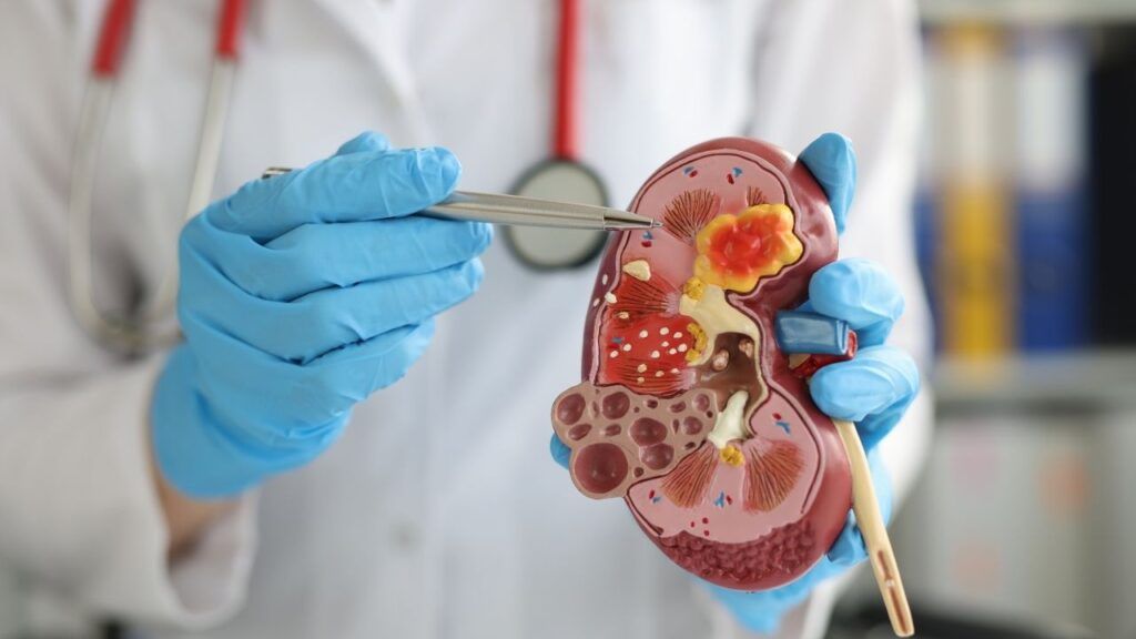 Kidney Stone Treatment in Vaishali – Advanced & Effective Care by Dr. Vimal Dassi